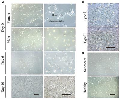 Generation of Urine Cell-Derived Non-integrative Human iPSCs and iNSCs: A Step-by-Step Optimized Protocol